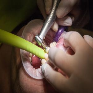 치아 건강에 중요한 영양소는 무엇이며 충치 예방에 어떤 영향을 미칠까요