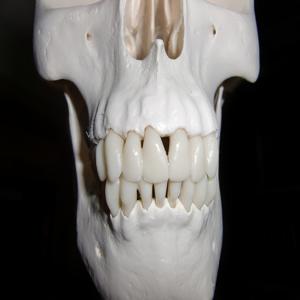 치아 미백과 충치 예방의 상관 관계